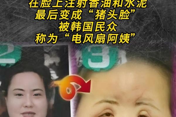 整容