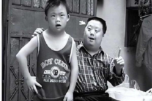 中国综合症
